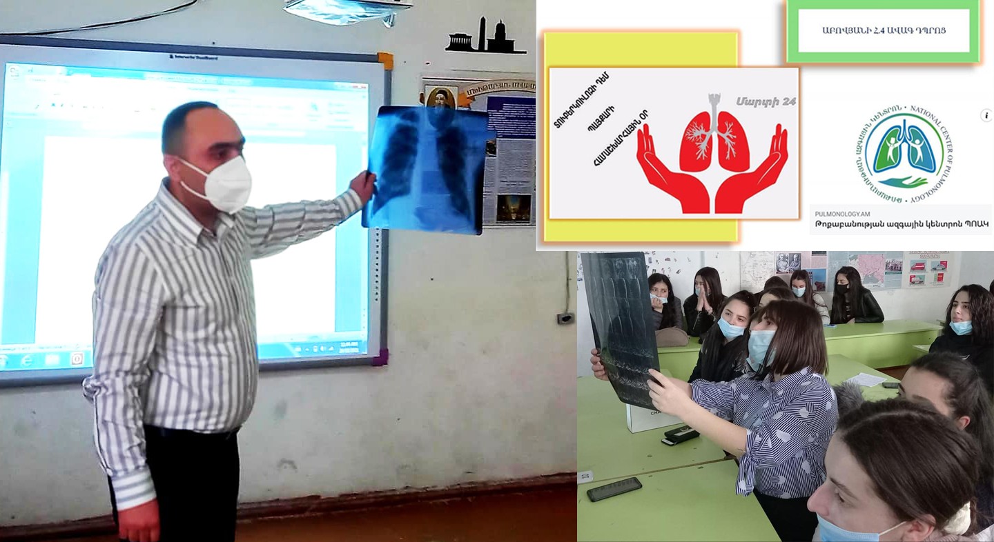 Seminar on tuberculosis in Abovyan High School # 4